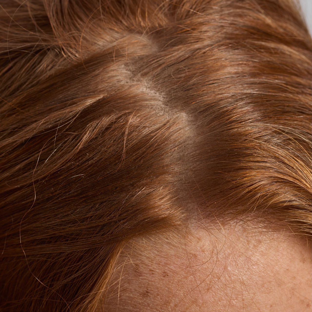 67830-60633-67823-Scalp_HairOilApplicator-Terracotta-Model-Consumables-1-Before-1280x1280px-1.jpg